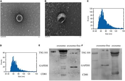 Plasma Exosome miRNAs Profile in Patients With ST-Segment Elevation Myocardial Infarction